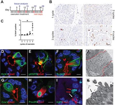 Tuft Cell Formation Reflects Epithelial Plasticity in Pancreatic Injury: Implications for Modeling Human Pancreatitis